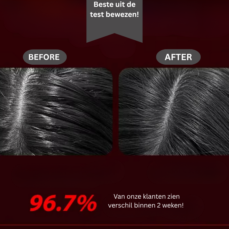 LumaScalp™ | voedt en bevorderd gezonde haarzakjes in de huid